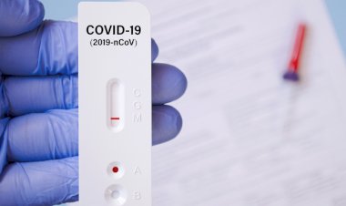 उत्तराखंड सरकार ने घटाई एंटीजन टेस्ट की कीमत