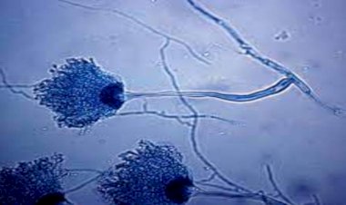 उत्तराखंड में ब्लैक फंगस के बाद अब इस फंगस ने दी दस्तक, 20 मरीजों का चल रहा इलाज