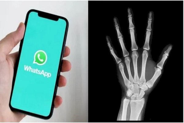 WhatsApp से ये कौन सी खतरनाक बीमारी हो रही? आप भी जान लीजिए, नहीं तो...